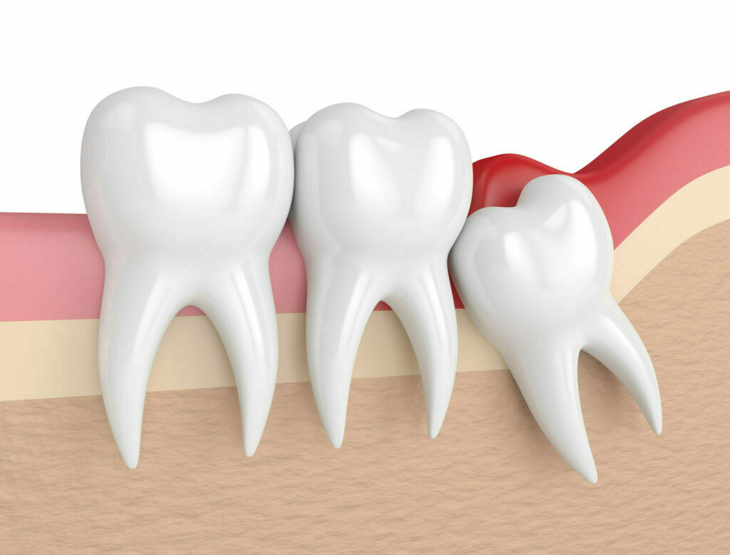 IStock 956382392 1024x778